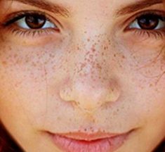 ¿Por Qué Aparecen las Pecas? Explicación Científica y Factores Clave